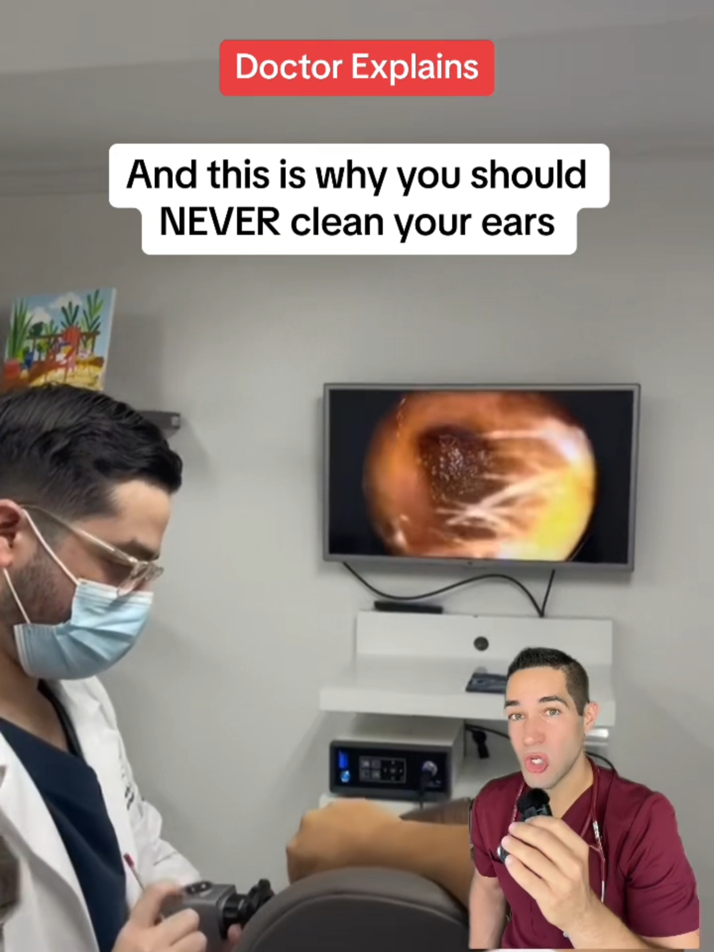 Q tips are NOT for cleaning ears! #earhealth #qtips #safety #medical