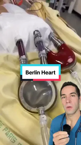 Usually gives you a few months #heart #medical #healthcare #heartfailure #lvad #vad #berlinheart #doctor #hospital #heartfailure 