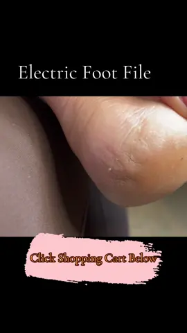 Every household needs these! #footfile #fissure #dryfeet #callus #giftidea @Pritech-US 