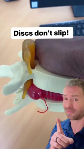 Disc bulge & herniation education - two tests & helpful drills! (bradley_blair_osteopath/IG) #backpain 