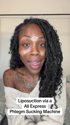 Enough is Enough!!! This has to stop the butchery, greed and lack of care for human life has to stop. I will be working hard with reputable practitioners to put and end to this disgusting behaviour.  #fyp #aesthetics #botched 