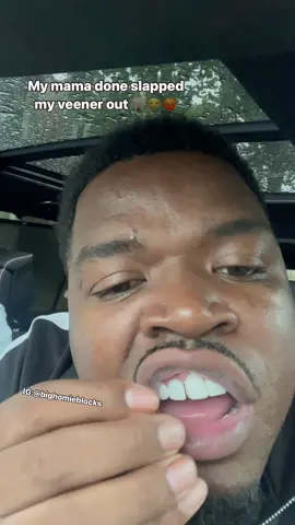 Smh mama you owe me a veneer 🦷🤦🏾‍♂️😭 @it_only_one_shonda 😤 #fyp #comedy #funny #reels #viral #bighomieblocks 
