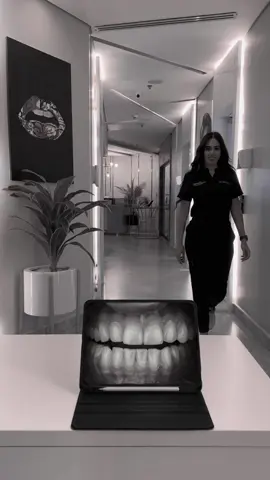 The power of a perfect smile in just one transition ✨🪄 #estheticdentistry #dentalesthetics #porcelainveneers #laminateveneers #cosmetics #smilemakeover #smilemaker #smiledesign #hollywoodsmile #dentalcosmetics #dentistryworldwide #dentalphotography#cairo#dubai#jeddah