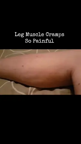 A leg cramp is an episode of sudden pain in the muscles of the leg. It's caused by an involuntary contracting (shortening) of the leg muscle. Cramps usually occur in the calf muscles, although they can affect any part of your leg. This includes your feet and thighs. #legmuscles #legmusclescramp #djtallykenya 