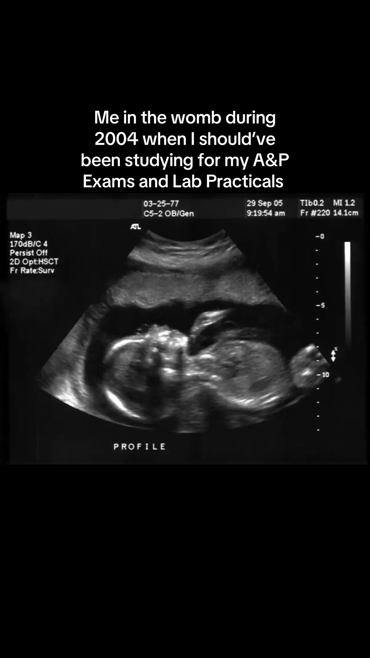 #fyp #stephenville #college #university #tarleton #foryou #anatomy #anatomyandphysiology #tx #science 