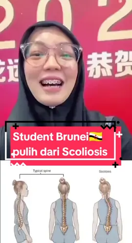 Nafeesa seorang students dari Brunei🇧🇳 yang belajar di UiA ,Kuala Lumpur. Mulanyaberikhtiar dengan Aulora Pants untuk cure period pain & back pain, ingatkan normal back pain turns out it's Scoliosis!  Sarung Aulora Pants sakit dari Scoliosis semakin berkurang, kita highly suggest Aulora pants combo with Aulora Seamless Bra untuk Scoliosis patient, InshaaAllah membantu! 🥰 Jom tonton video ni sampaj habis,utk ibuayah yang anaknya ada masalah Scoliosis bole berikhtiar dengan Aulora Pants👖  Biznillah. #tulangbelakangS #scoliosis  #tulangbelakangbengkok #Auloragentleterapy  #farinfrared 