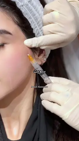 اجراء سكالبترا محفز الكولاجين🤍  يعمل على تحسين جودة الجلد البشرة تصير مشرقة أكثر واثار التعب او الارهاق تختفي تبين البشرة بشكل اصغر بالعمر وصحية سويته مع د. منى في عيادة برايت سويت معها مورفيس+ اكسوزومز قبل والجلسات مثبته 🤍AD #سكالبترا #سكلبترا #scuptra  #capcut #Tiktok #tiktokshop #viral #haul #explore #اكسبلورر #اكسبلورexplore #اكسبلوررررر #fyp #fory #fyppppppppppppppppppppppp #skincare #skincareroutine #tipsandtricks  @Amal Alammar  @Amal Alammar  @Amal Alammar 