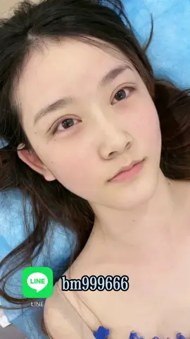 #雙眼皮 #臺北無痕雙眼皮 #無痕雙眼皮 #眼周 #臺北 #台灣 