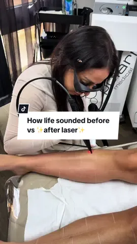 Quality of life 📈😅 these results are after only 2 sessions as well… #laserhairremoval #laserhairremovaltreatment #hairfree 