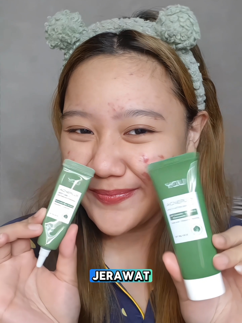 combo buat jerawat yg selalu aku pake🥰✅ #youacneplus #bestcomboforacne #acneskin #racunskincare #skincare #kulitberjerawat 
