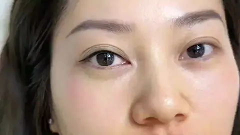 ❤️做完一邊美瞳線對比圖改善眼睛無神 #高雄旗山霧眉 #高雄美瞳隱形眼線 #野生眉 #歐洲唇🫦 #歡迎資訊❤️ 