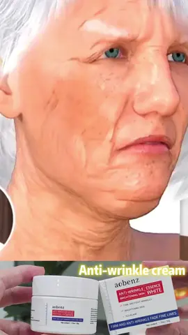 Qw take care of your skin with aobenz  cream#foryou #skincare #wrinkle 