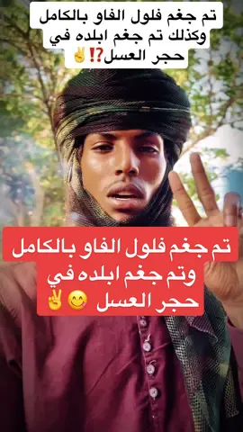 بحمد الله الان اشا'وس قوا'ت الد'عم السر'يع يجغمون فلو'ل الفا'و بالكامل وكذلك تم التعامل مع ابلده في حجر العسل خير المعامله وتم الجغم ايضا بالكامل 😋|||| #آل_وداعةالله #السودان #عاجل #اخبار_السودان #الخرطوم #بحري #امدرمان #الفاشر #foryou #اكسبلورexplore #اكسبلور #السعودية #مصر #الامارات #تشاد #فرنسا #المانيا #فرنسا🇨🇵_بلجيكا🇧🇪_المانيا🇩🇪_اسبانيا🇪🇸 #الولايات_المتحدة_الامريكية @maisara Boos619 @🈴♕ نادر الهلباوي ♕ 🈴 @خليل موسي قارح ✈️❤️ @الثائر Altaher✌️🇸🇩🇧🇻 @الرينو @ظافر 911🦅 @ضبة✌️🇸🇩 @ام أشواق حامد😍2 @امير البدو ⚔️🥷 @خربانة ام قدود 💔 @بشر تكيزو 