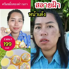 #ครีมขมิ้นทองคำช่วยเรื่องสิวฝ้ากระหน้าหมองคล้ำทาเช้าเย็นได้เลยคะ 