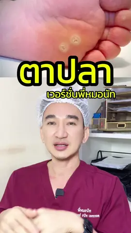 ตาปลา ไม่ใช่หูดน่าาา 🙅 #ตาปลา #หูด #corn #wart #พี่หมอนัทขอเล่า #รักษาตาปลา #รักษาหูด #ริณมณีย์คลินิก #ผ่าตาปลา #เลเซอร์ตาปลา 