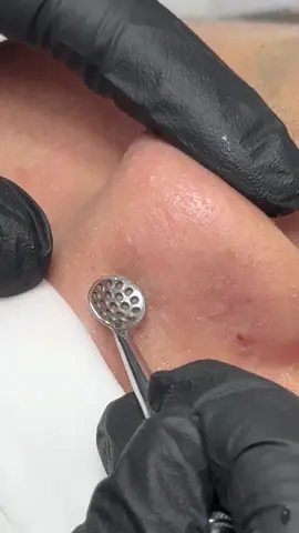 Deep clean luôn là dịch vụ hot bên nhà Linh giúp quá trình nặn mụn dễ hơn khách cũng k còn đ.au như các phương pháp truyền thống 🌱 Ưu đãi 1 buổi deep clean chỉ 3.5.0 cành 📲 #linhphambeautyspa#trimun #trimunkhoahoc #duocmypham #nanmunkhongdau #ghiennanmun 