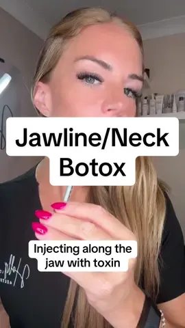Lower face toxin placement can really help to subtly lift the face and reduce lines amd wrinkles.  #botox #facelift #aesthetics #hollylouiseaesthetics #fyp #tiktoknews #besuty #medical #jawline #lowerfacebotox 