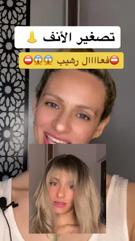 تابعونى على انستا #نيللى_الفزيعه  #تصغير_الانف #تصغير_الخشم #تطوير_الشخصية #تنمية_بشرية  #تجميل_الوجه #تجميل_جمال_البشره_علاجات_للبشره #تجميل_النساء #الشعب_الصيني_ماله_حل😂😂  #للبنات #للبنات_بس #ملكة_جمال #فزيعه #عملية_تجميل #جراحة_التجميل   #انف #الانف  #تصغير_الانف_بدون_جراحه  