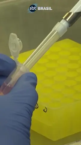 Pessoa com diabetes tipo 1 é curada pela primeira vez #fyp #foryoupage #sbtnews #sbtbrasil #jornalismo