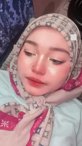 braces area kuala terengganu 🦷 #fyp #braces #bracesbysyaaabeauty #fashion 