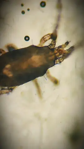 Cheetos under microscope 😐 #undermicroscope #cheetos #biology #Science #microscope #microbiology #bacteria #parasite #doyouknow #viral 