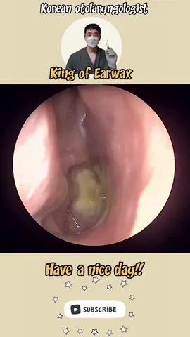 @귀지형 #콧물 #부비동염 #축농증 #비염 #코청소 #이비인후과 #rhinorrhea #rhinitis #sinusitis #asmr #ENT #entdoctor 