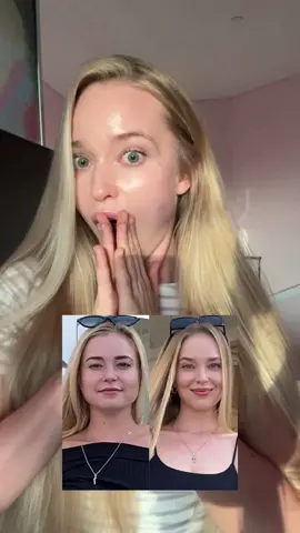 Want a natural face lift? Then this technique is PERFECT for you. Do it daily for optimal results. Which area do you need help with the most? Let me know in the comments 👌  #facemassage#naturalfacelift#GlowUp#faceroutine#beforeafter#beauty#beautytips 