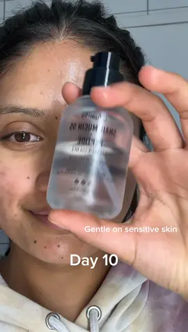 Seeing this all over my feed, so I had to try it! 🌿  After two weeks, my skin feels calmer and less irritated. It’s not a miracle, but it’s helped with the redness and inflammation. If you’ve got sensitive skin like mine, this might be worth a try! 💧 @Jumiso Official snail musin 95+ peptide essence . . . . . . . . . . . #jumiso #snailmusin #peptide #essence #jumisosnailmucin #sensitiveskin #jumisopartner #acnesensitive #acnesensitiveskin #acneproneskin #sensitiveskincare #skincare #skincareroutine #acneskincare 