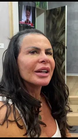 Olhem o que a gretchen fala sobre seu cabelo!! #gretchen #viraltiktok #inovaçao #viral #alopecia #tiktok #megahairdefita #autoestima #alopeciaandrogenetica #alopecia 