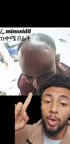 #minoxidil #hairgrowth #ethiopian_tik_tok🇪🇹🇪🇹🇪🇹🇪🇹 