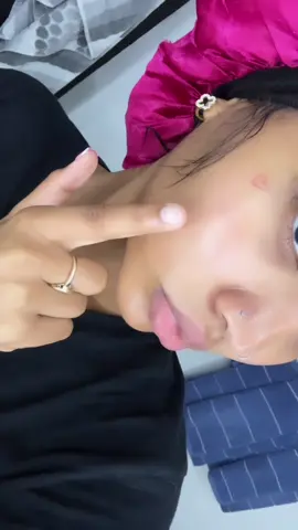 THIS IS YOUR SIGN TO TAKE THE RISK & CLEAR YOUR ACNE FOR GOOD ‼️* disclaimer this is what worked for me with consistency these products do NOT work overnight * #acne #koreanskincare #trending 