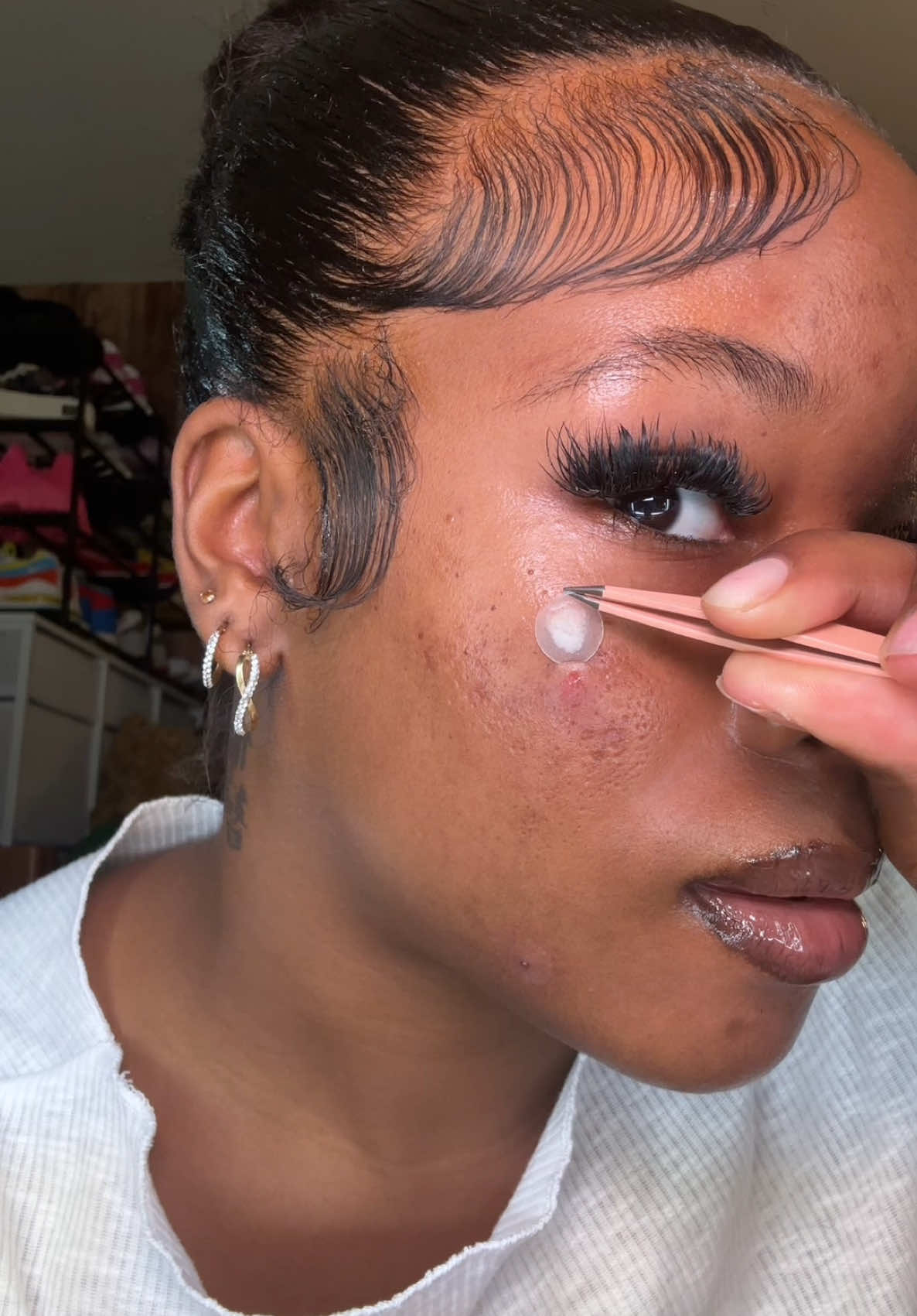 Replying to @Alyssa☁︎︎༅ so sorry for the wait 🫶🏾 #skintok #satisfying #pimplepatchremoval 