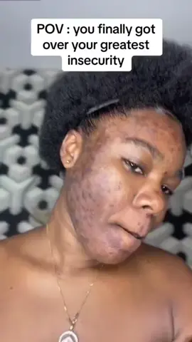 #fyp #clearskin #turmericsoap #richandclear #forupage #4upage 