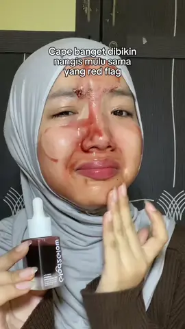 Emang cuman G2G Peeling Solution yg red flag tpi ga ngcwain