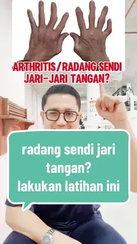 arthritis atau radang sendi jari tangan? lakukan latihan ini #drpras #fyp #arthritis #rheumatoidarthritis 