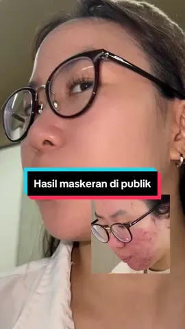 Hasil maskeran di publik, ngonten boleh bercandaan tapi hasil RIIL bro 🤙  #glassskin #facemask #fyp #polynia #gajiansale #beforeandafter #glowing #skinjourney #skincaretips 