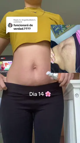 Replying to @AngelikaMelo ADIOS ESTRIAS ADIOS FLACIDEZ 🌸✨… En el link de arriba la puedes comprar ✨ #estrias #todoelmundo #cuidadodelapiel #producto #TikTokShop #destacame #hazmeviral #flacidez #bflat #crema #eficaz #resultados #octoberfinds #blowthisup #paratii #stretchmarks #looseskin #maelys 