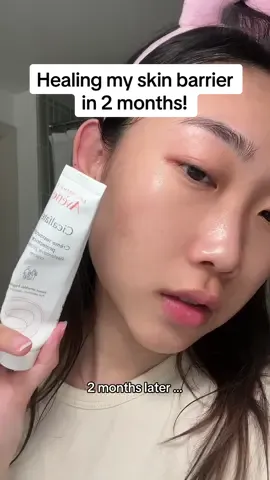 Never taking clear skin for granted again 🥺 my skin is nowhere near perfect rn but patience is key 🗝️ should i post an updated skincare routine?  #acne #skinbarrier #avenecicalfate #fyp #breakouts #pimple 