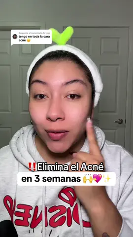 Respuesta a @yeye Skincare para niñas con piel mixta o grasa 🧴💖✨ #skincareniñas #acne #acnetreatment #blackhead #pielsensible #pielmixta #pielgrasa #SkinCare #numbuzin #acneproneskin #acidopantotenico #allskintypes #teampantothenicacid #pantothenicacid #koreanskincare #kbeauty #sephorakids #adolescentes #beauty @numbuzin Official 