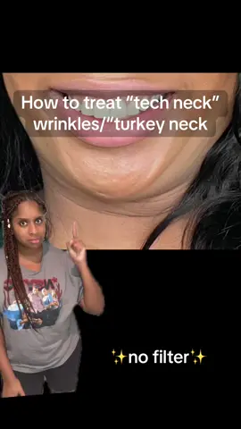 It’s on sale AND in stock! Run don’t walk while supplies last.  #antiagingskincare #wrinkles #gopure #skincare #youngerlookingskin #tiktokshop #skincareroutine #neckcream #crueltyfree #veganproducts 