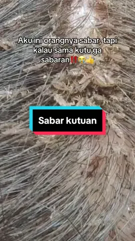 Ayo siapa yang sama ga sabaran sama kutu?😭😭 #kuturambut #obatkutu #minyakrambutviral #obatkutuanak #shinelooks #obatkuturambut 