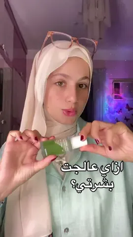 السيرم الي حرفيًا انقذلي بشرتي 😍 @celimax.global #celimax #noniampoule 