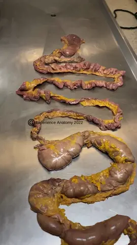 The small intestine's primary function is nutrient absorption, while the large intestine focuses on water and vitamin absorption. When stretched out, the small and large intestine is 22 feet long.  When the large intestine is not functioning properly, diarrhea can occur due to the influx of water in the colon.