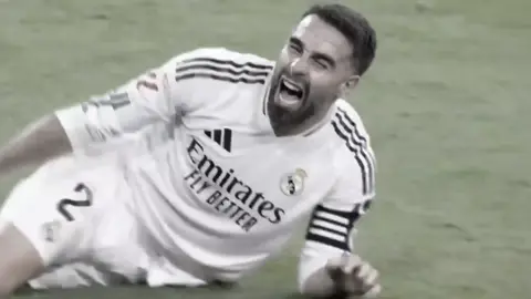 مراح نتخطى هاي الصرخه😭💔#كارفخال #ريال_مدريد #اصابات_الركبه #رباط_صليبي #لقطات #حزينه #هلا_مدريد #realmadrid #carvajal #halamadrid 