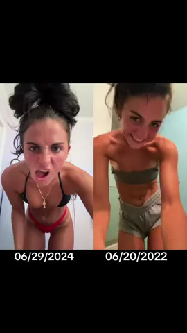 2 year difference but recovery and getting healthy is pretty cool and worth it