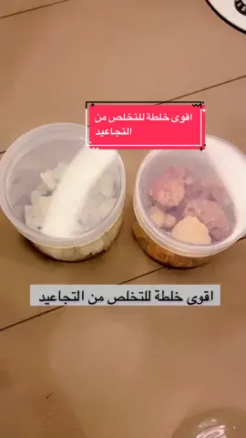 اقوى خلطة للتخلص من التجاعيد #االعناية_بالبشرة #خلطات_طبيعية #ماسكات_بشره #التجاعيد 