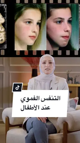 كنتوا بتعرفوا إنه التنفس الفموي عند أطفالكم ممكن يسببلهم مشكلة حقيقية؟ 