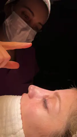 Rhinoplasty Turkey👃 . . . . #rhinoplasty#rhinoplastie#rhinoplastybeforeafter#rinoplasti#rhinoplastyturkey#rinoplastiizmir#burunestetigi#revisionrhinoplasty#nasenkorrektur#manrhinoplasty#rinoplastika#barbienose 