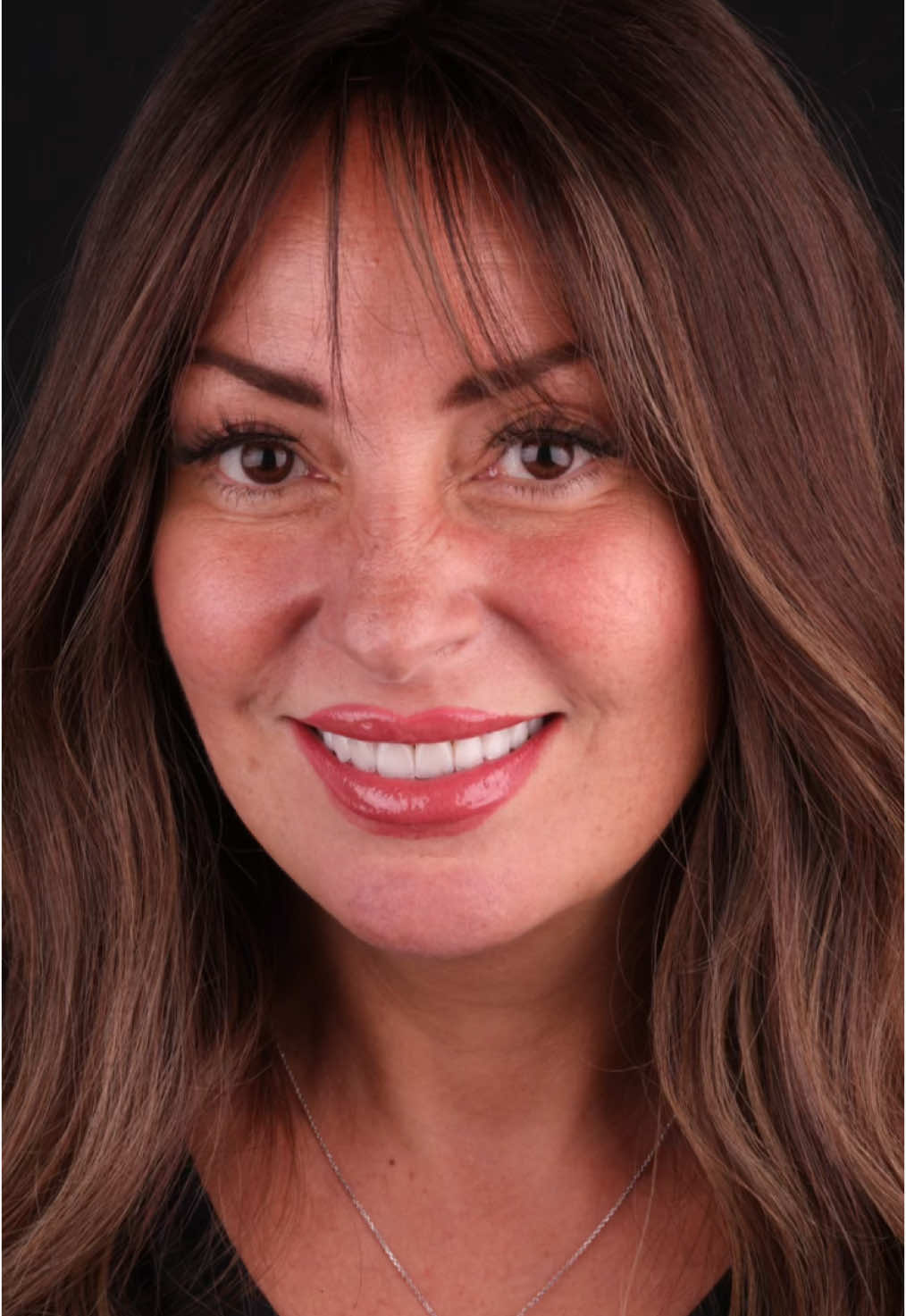 When your smile say it all! 💖 Veneers at Whity Clinic Dr. Mohamed Emad for a flawless, radiant look. #veneertransformation #smiletransformation #perfectsmile #teethgoals #flawlesssmile #smileperfection #estheticdentistry #dentalesthetics #porcelainveneers #laminateveneers #cosmetics #smilemakeover #smilemaker #smiledesign #hollywoodsmile #dentalcosmetics #dentistryworldwide #dentalphotography #cairo #dubai #jeddah 