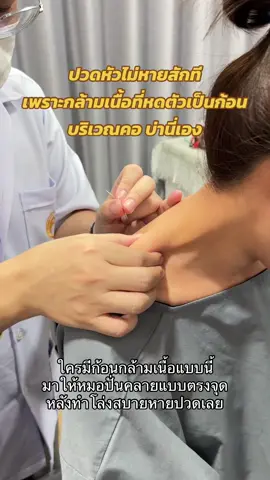 ปวดหัวไม่หายสักที ต้องมาลอง ปั่นคลายปมกล้ามเนื้อที่คอบ่า รับรอง โล่ง เบา สบาย #ฝังเข็ม #dryneedling #dryneedlingtherapy #แพทย์แผนจีน #ปวดหัวไมเกรน #ปวดหัว #ออฟฟิศซินโดรม #ปวดหลัง #ปวดคอบ่าไหล่ #ฟาจินคลินิก 